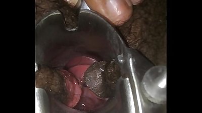 Black Female Breeded / Inseminated by White Male Video 4